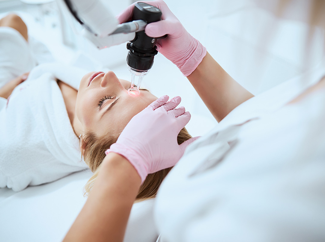 Zdjęcie przedstawia zabieg laseroterapii, który poprawia wygląd skóry, redukując zmarszczki i przebarwienia, oraz stymuluje jej naturalną regenerację.